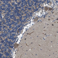 PIP5K1C Antibody, Novus Biologicals 25 &mu;L; Unlabeled:Antibodies, Polyclonal